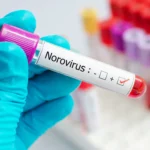 Norovirus Outbreak: What You Need to Know and How to Stay Safe