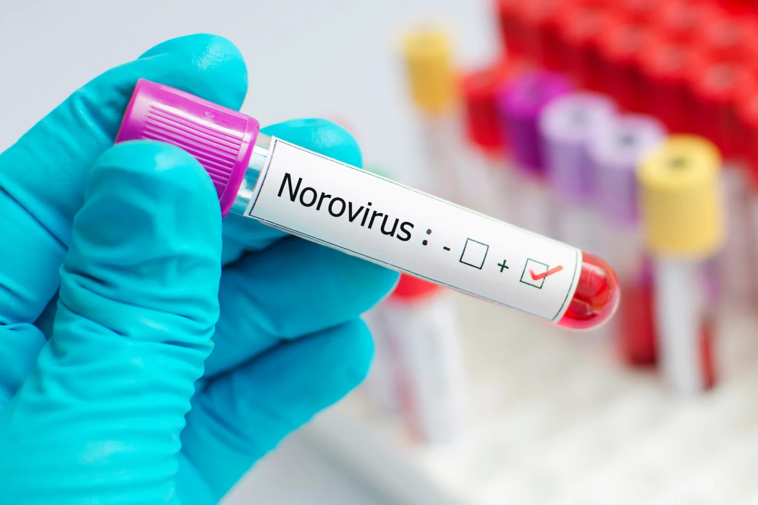 Norovirus Outbreak: What You Need to Know and How to Stay Safe