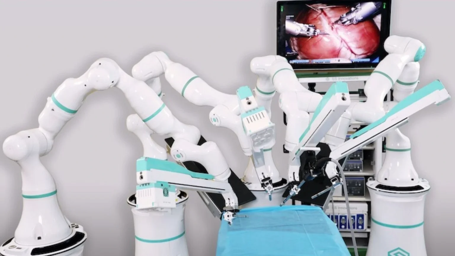 India’s SSI Mantra Achieves World-First Robotic Cardiac Telesurgeries India’s SSI Mantra Achieves World-First Robotic Cardiac Telesurgeries